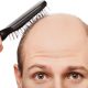 hair loss